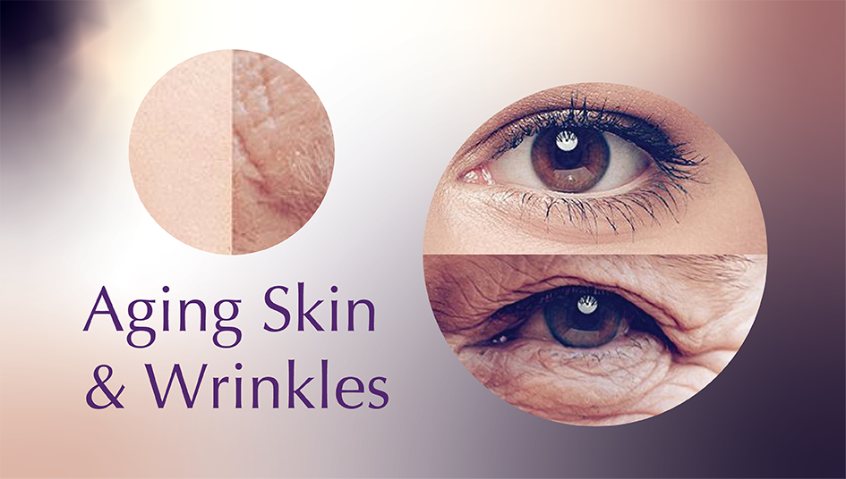 Aging Skin & Wrinkles 945×536 Aging Skin & Wrinkles 945x536