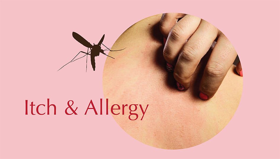 Itch-&-Allergy-945×536 Itch-&-Allergy-945x536