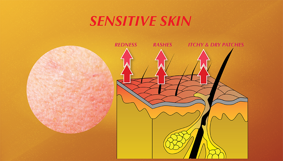 Sensitive Skin 945×536 Sensitive Skin 945x536