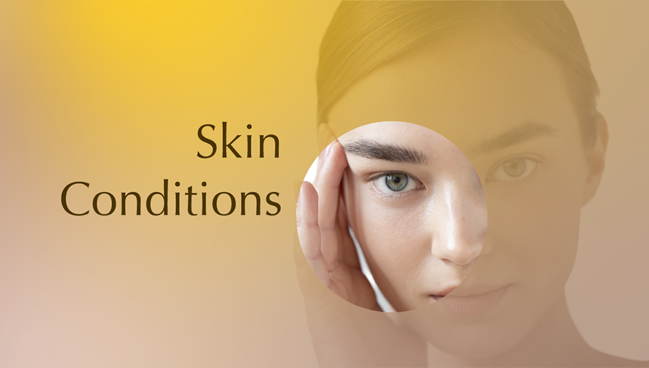 Skin Conditions 945×536 Skin Conditions 945x536
